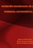 SINDROME DE SECRECION INADECUADA DE LA HORMONA ANTIDIURÉTICA