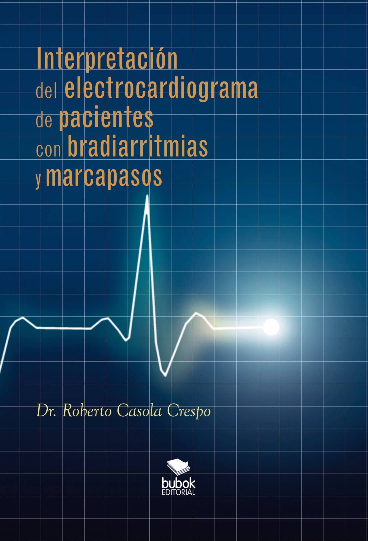 interpretación del electrocardiograma