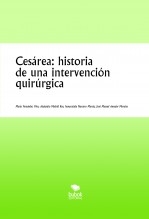 Cesárea: historia de una intervención quirúrgica