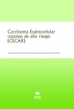 Carcinoma Espinocelular cutáneo de alto riesgo (CECAR)