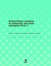 Bradiarritmias y sistemas de conducción. Una visión emergente (Parte 1)