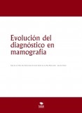 Evolución del diagnóstico en mamografía