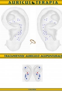 Auriculoterpia Práctica Terapeútica